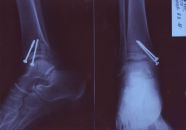 Фотография Груничева Виталия